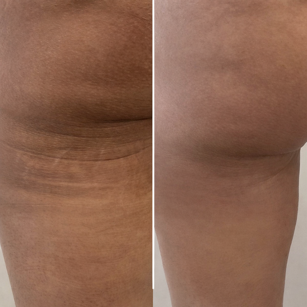 Selfie résultat client