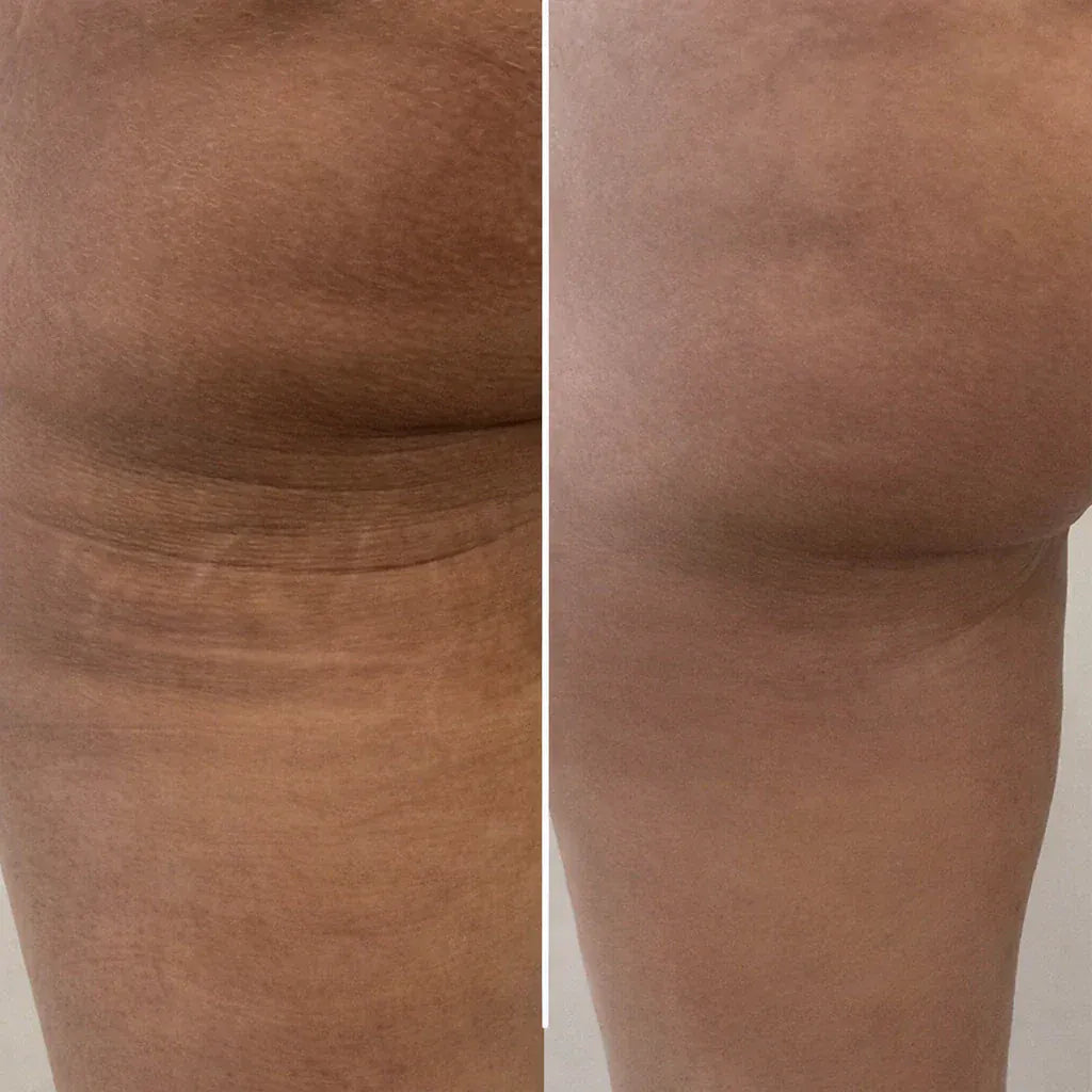 Selfie résultat client