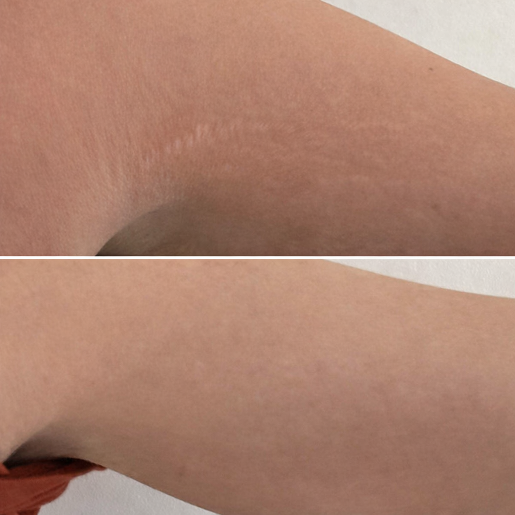 Selfie résultat client