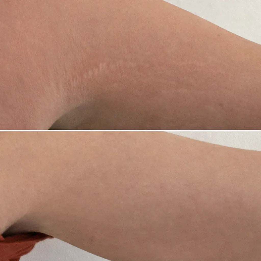 Selfie résultat client