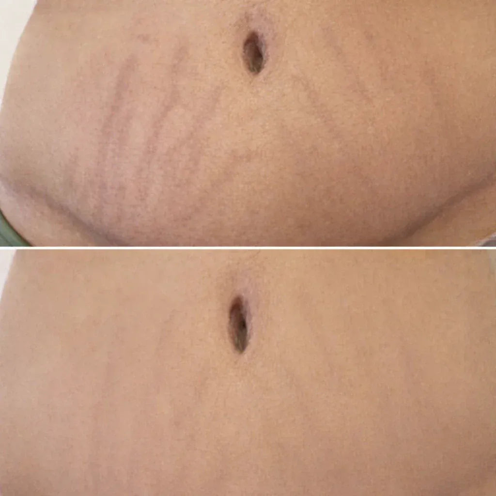 Avant / après résultat client