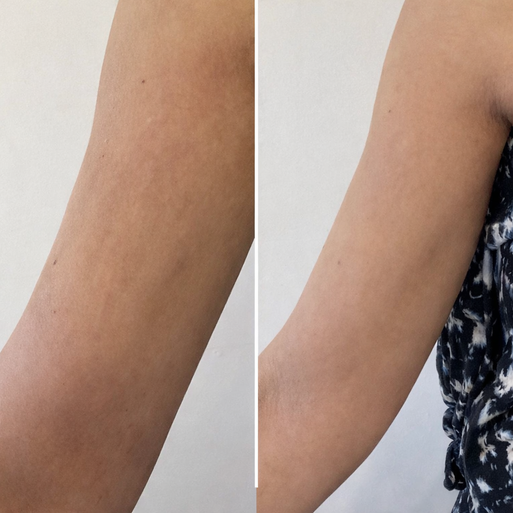 Selfie résultat client