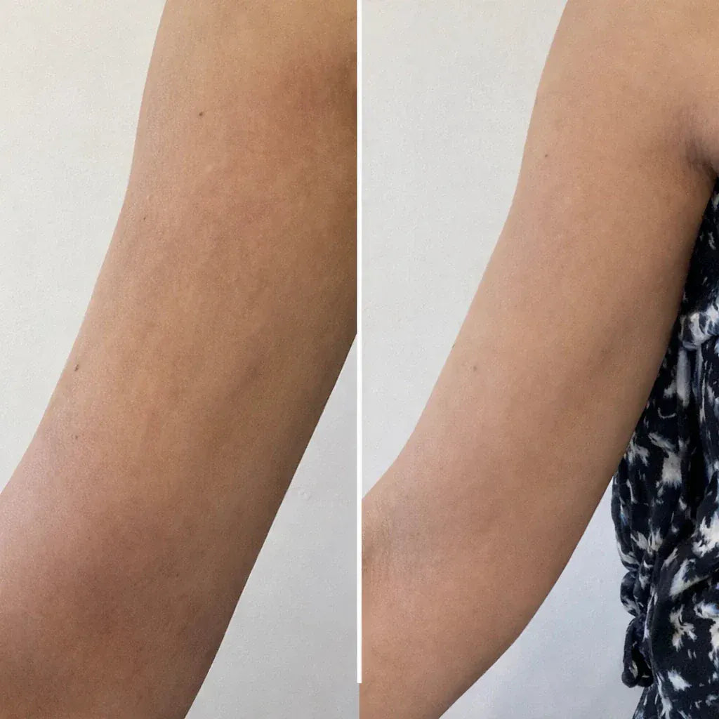 Selfie résultat client