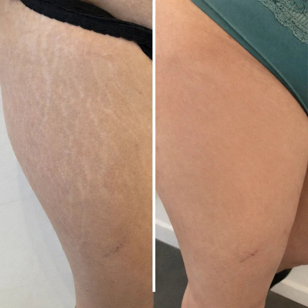 Selfie résultat client