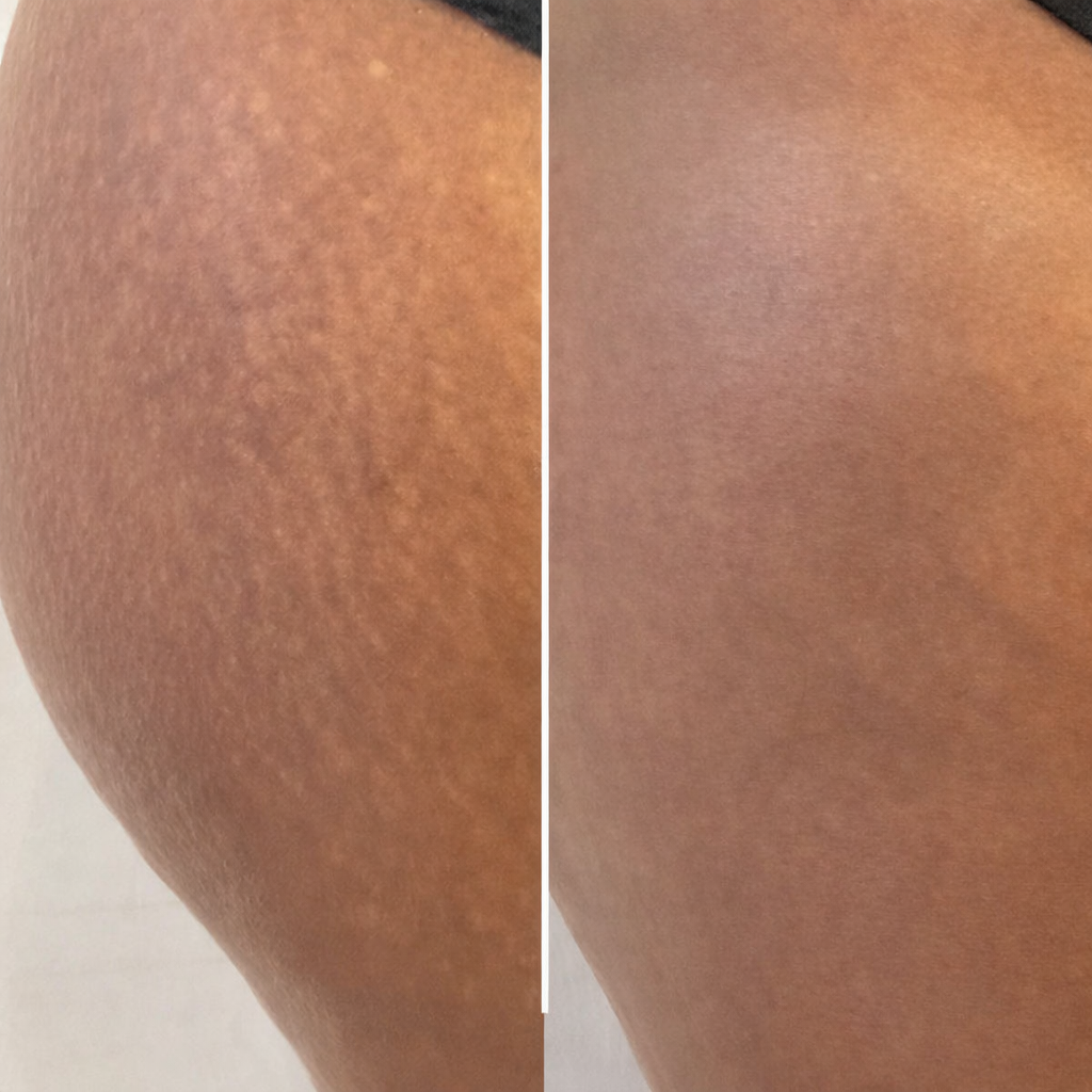 Selfie résultat client